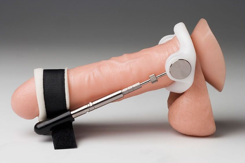 Lo más habitual es que se utilicen un extensor y bombas de vacío para agrandar la cabeza.