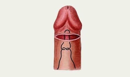 bellota